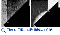 図15-3　テプラーのスケッチ