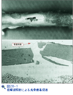 図28-1　衝撃波照射による兎骨癒着促進