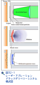 図32-1　レーザーアブレーションドラックデリベリーシステム模式図