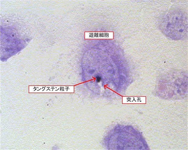 図32-3　遊離細胞中に貫入した直径1μmのタングステン粒子（東北大学医学研究科荒井教授提供）