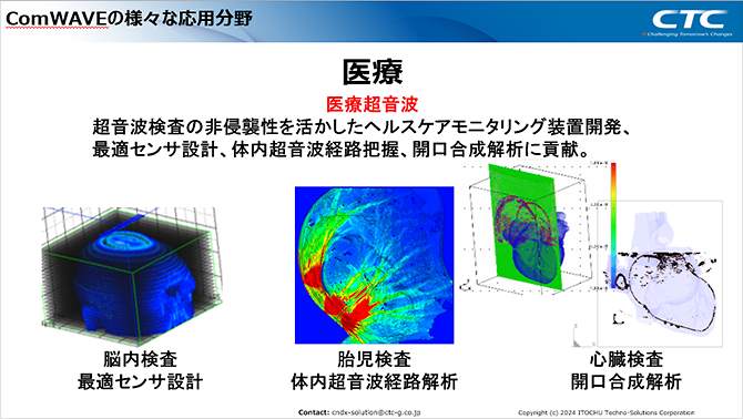 図3　ComWAVEの応用分野（医療分野）
