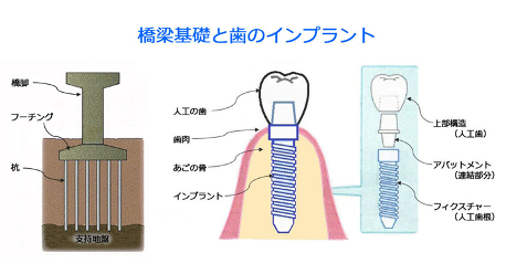 テクニカルレポート：Web講座：画像で見る 土木の不思議(メルマガアーカイブス)